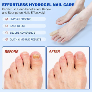 Hydrogel Nail Repair Patches  21 PCS 
