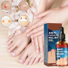 Anti Paronychia Relief Oil