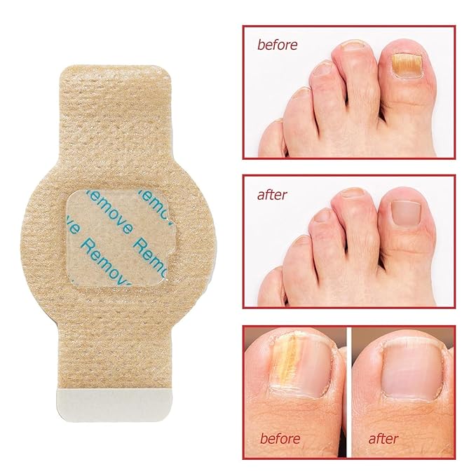 Hydrogel Nail Repair Patches  21 PCS 